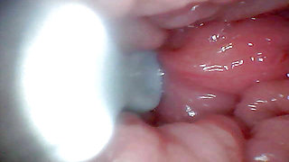 First time: An endoscope reveals the G-spot up close - without mountingl