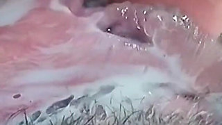 Selection of Vacuum Masturbation of the Vagina