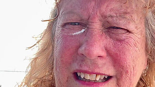 Putting Sunscreen on Every Last Freckle