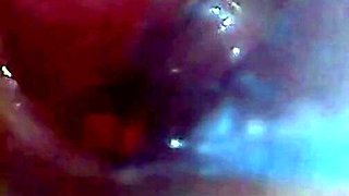 Endoscope POV: Test Tube Cock Urethral Insertion