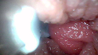 Visual Guide to G-Spot Stimulation and Orgasm - Endoscopic Perspective