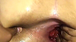 He Opens My Asshole Like a Bitch! Huge Gape, Prolapse, and Bubbling Farts!