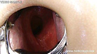 Deep View and Deep Play. Xo Speculum Huge Gape by Hotkinkyjo