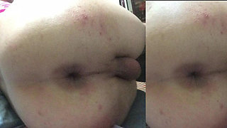 My gape anal pic colections