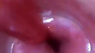 Test tube cock endoscope POV urethral insertion ball rod