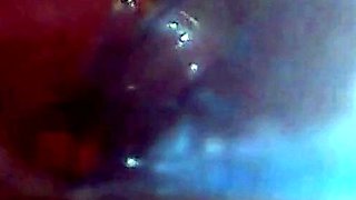 Endoscope POV: Test Tube Cock Urethral Insertion