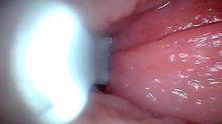 First Time: an Endoscope Reveals the G-spot up Close - Without Mounting!