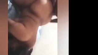 I Told Him About My Back What My Boss Did Next