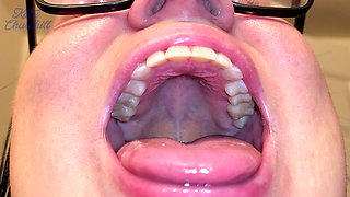 Mouth Tour with a Bottom Retainer