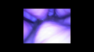 Speculum & Microcamera for Lady Soniac