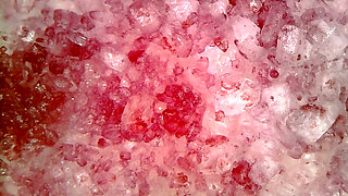 Medical Endoscope Oral Exam: Gummy Chewing, Extreme Teeth & Tongue Macro