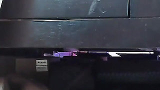 My Dry Feet Heels and Soles